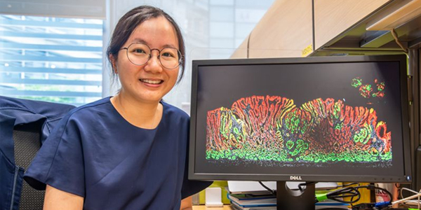 Zeroing in on the Root of Gastric Cancer
