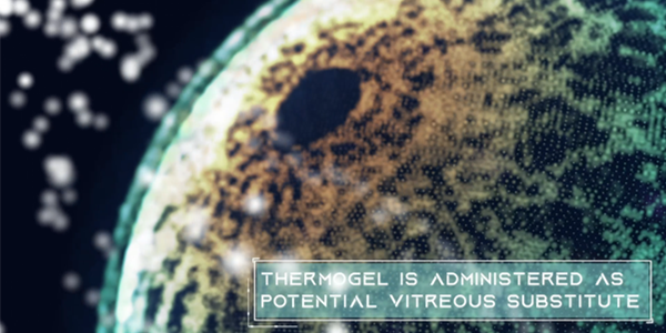 Thermogel: An Emerging Biomaterial for Biomedical Applications